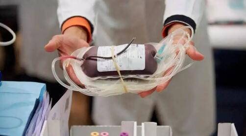 男子發燒超40度臉部全是汗還冒煙 引起很多網友關注