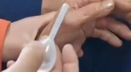 開塞露救了差點被剪的藍寶石戒指 藍朋友也太機智了