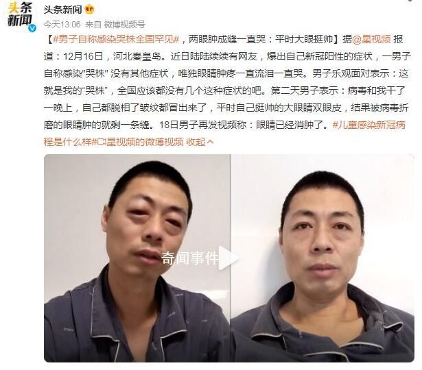 男子自稱感染“哭株”全國罕見 眼睛腫疼一直流淚一直哭