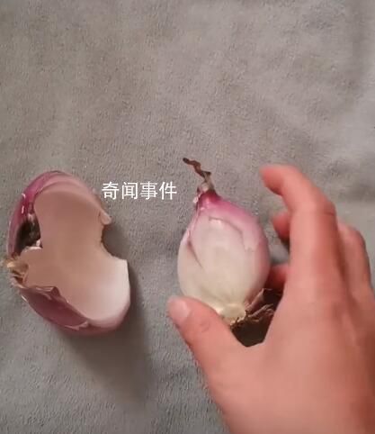 女子一家三口發燒用洋蔥退熱成功 網友表示用了沒退下來