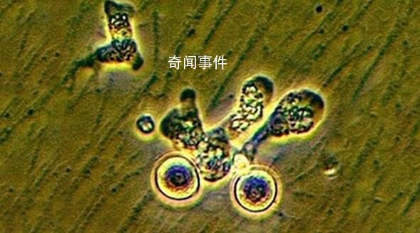 韓國報告首例“食腦蟲”病例 從泰國回國后死亡