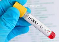 俄全境地區均現甲型H1N1流感 呼吸道感染發病率下降了7%