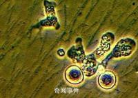新冠肺炎更名為新冠感染 下月8日起實施乙類乙管
