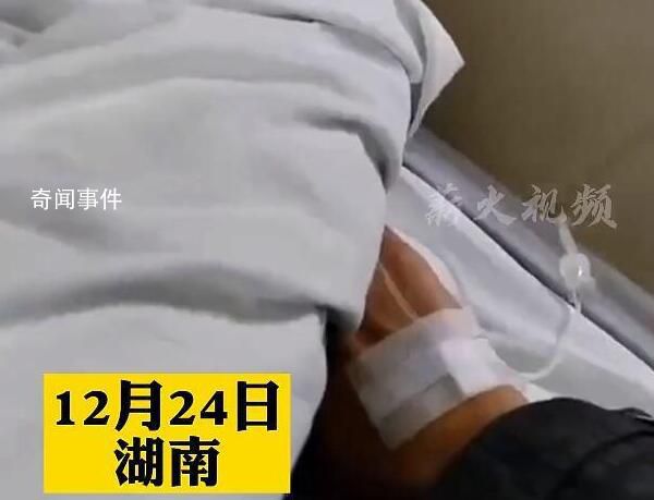 男子陽了雙肺感染咳斷三根肋骨 診所打吊針不管用