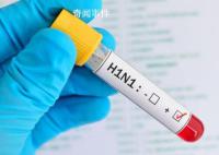 俄羅斯全境均出現甲型H1N1 目前尚無動物傳染人類的證據
