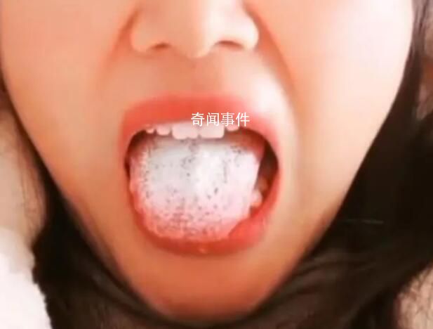 女子陽后舌頭長滿厚白舌苔 讓網(wǎng)友議論紛紛