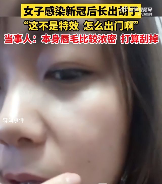 女生回應感染新冠后長出胡子 稱這不是特效
