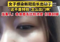 女生回應(yīng)感染新冠后長(zhǎng)出胡子 稱這不是特效