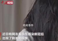 專家說感染新冠后脫發比較普遍 多長時間可以恢復