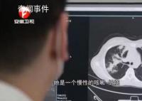 女子接觸發霉玉米肺里長黃曲霉菌 醫生科普毒性超強