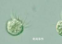 科學家首次發現專吃病毒生物 可以主動食用病毒并茁壯成長