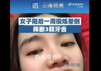 女子陽后一周鍛煉暈倒摔斷3顆牙 康復期勿劇烈運動