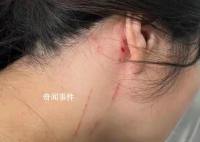 回家過年拒絕相親 河南母女被打入院