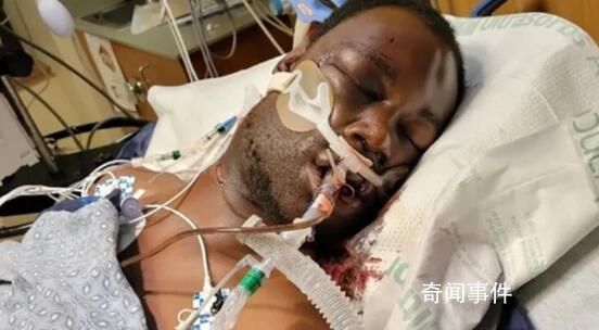 美國5名警察將黑人司機(jī)毆打致死 涉事警察已被開除