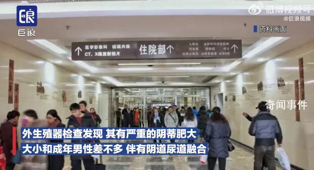 夫妻連生兩胎均患怪病性別難辨 確診先天性腎上腺皮質(zhì)增生癥