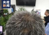 現實版安欣38歲滿頭白發 愿每次出警都能平安歸來