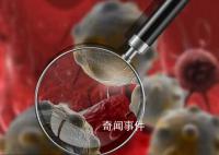 中國(guó)癌癥死亡50年:肺癌增長(zhǎng)最快