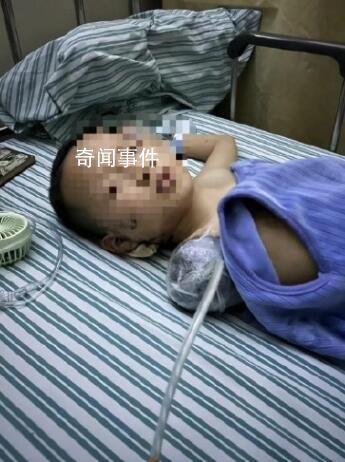 鄰居扔偏炮仗致男童截肢 當事人回應