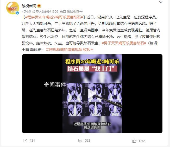 程序員20年喝近2噸可樂屢患結石 患結石已經多年