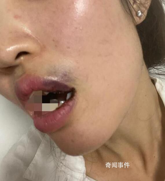 吳秀波兒子疑家暴女友 吳瀚前女友稱吳瀚曾對其施暴