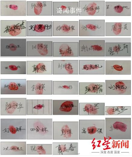 38位戈謝病患者家庭聯名求藥 戈謝病是什么病能治愈嗎