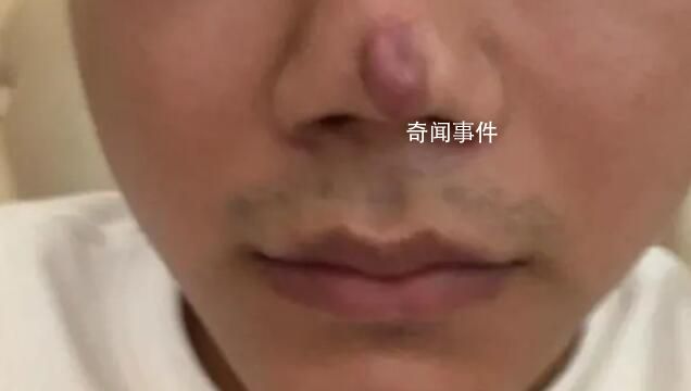 男子整形后稱沒法靠顏值吃飯了 現在沒法繼續工作了