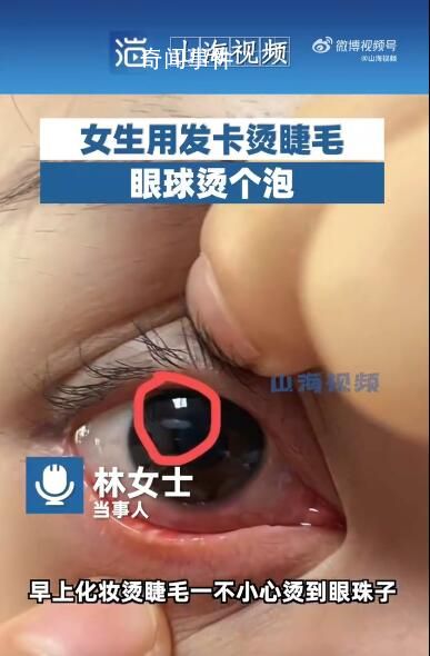 女生用發卡燙睫毛眼球燙個泡 提醒大家化妝時要注意安全