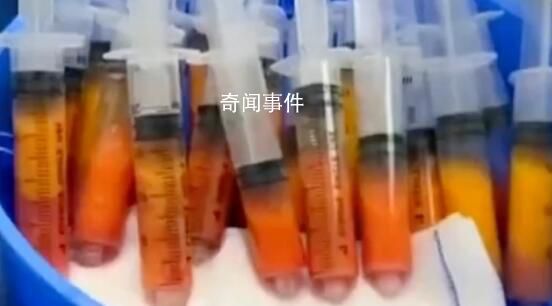 19歲女孩整形醫院抽脂3天后死亡 主診醫生被判處有期徒刑十個月