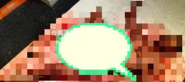 巴厘島身亡中國男子掙扎爬行20分鐘 脖子等處有傷口
