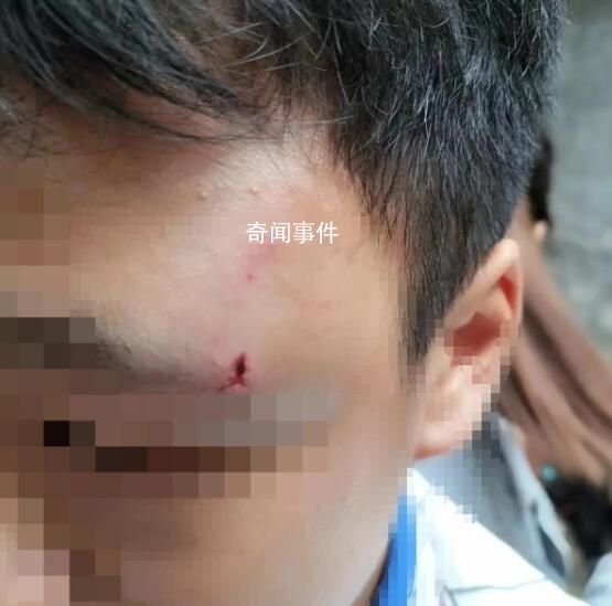 學生被老師丈夫刺傷?學校回應