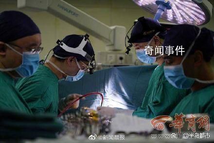 全國首例心臟不停跳人工心臟植入 這些患者手術前都是重度心衰