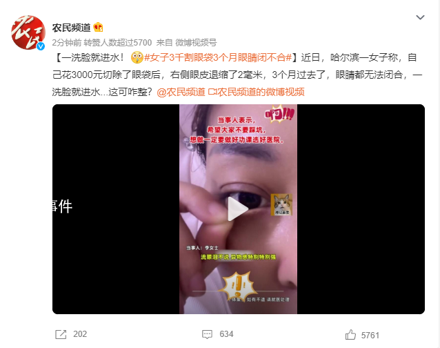 女子3千割眼袋3個月眼睛閉不合 一洗臉就進水