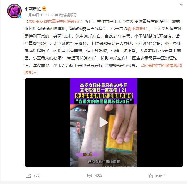 25歲女孩體重只有60多斤 身體基本沒脂肪了