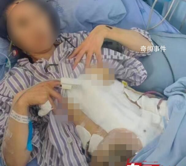 女主播遭家暴內臟破裂 丈夫被刑拘