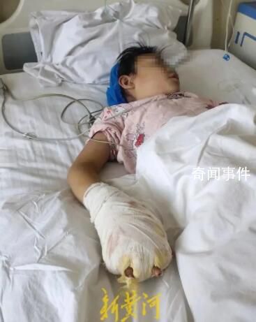 女童被繼母虐待致殘 其父稱絕不和解
