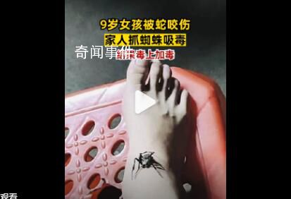 女孩被蛇咬傷奶奶抓蜘蛛吸毒 不僅沒有好轉(zhuǎn)反而口腔出血嚴(yán)重