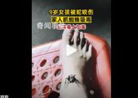 女孩被蛇咬傷奶奶抓蜘蛛吸毒 不僅沒有好轉(zhuǎn)反而口腔出血嚴(yán)重