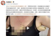 女子用絲襪包5條活蛇藏胸部入境 該批玉米錦蛇已交由相關部門處理