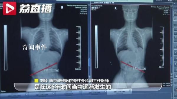 僅3周接診5名下腰癱瘓孩子 背后真相令人震驚