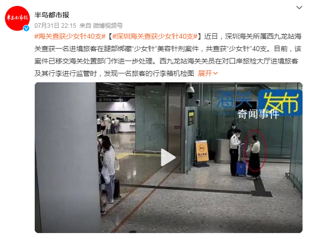 女子過海關(guān)雙腿綁滿少女針 已移交海關(guān)處置部門作進(jìn)一步處理