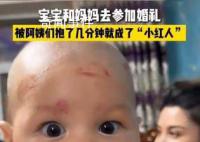 寶寶參加婚禮被親一臉口紅印 成為了小紅人
