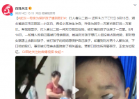 母親為保護(hù)孩子遭到毆打 正全方位取證