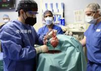 豬腎移植人體后成功撐過1個月 或成器官短缺新希望