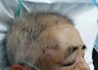 孫子目睹爺爺遭村霸毆打后疑抑郁跳河 老人被毆打腦出血入院
