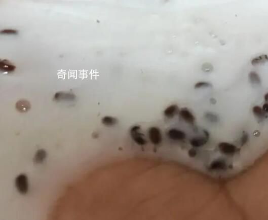 女生稱海飛絲洗發水擠出大量蟲卵 實在是太惡心了