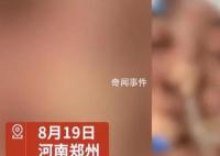 女子沒給丈夫錢充手游被毆打失明 目前警方已經介入調查