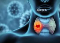 浙江12歲女孩確診甲狀腺癌 小小年紀為什么會扯上甲狀腺癌