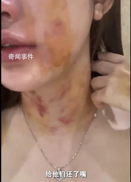 23歲女子自曝遭夫妻兩人毆打扒衣 當事雙方按照流程做傷情鑒定