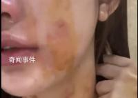 23歲女子自曝遭夫妻兩人毆打扒衣 當(dāng)事雙方按照流程做傷情鑒定