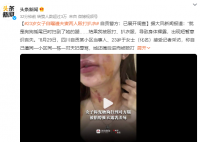 女子遭夫妻扒衣掐脖?警方介入